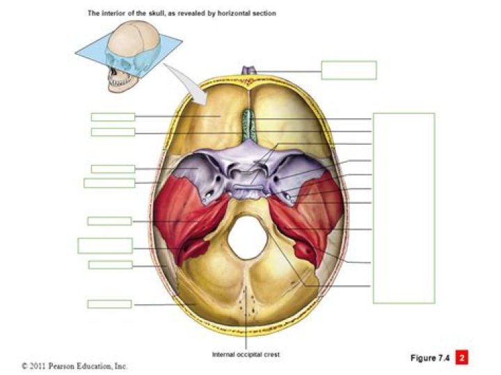 Human Skull: Horizontal Cross Section Quiz