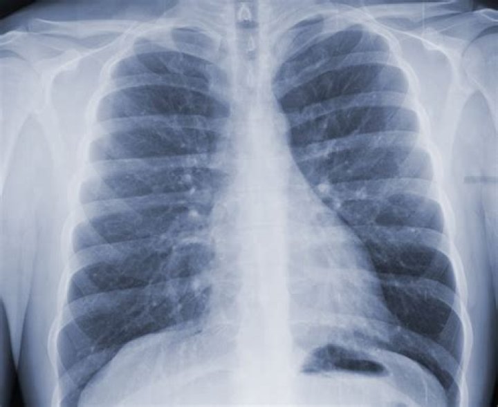 Raio X tórax Quiz